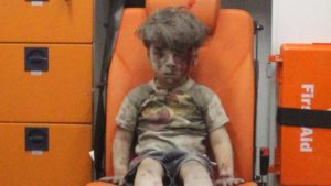 suriah omran daqneesh